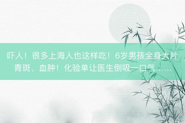 吓人！很多上海人也这样吃！6岁男孩全身大片青斑、血肿！化验单让医生倒吸一口气……